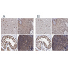 Anti-PSMD4 Antibody