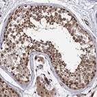 Anti-PSMD4 Antibody