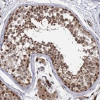 Immunohistochemical staining of human testis shows moderate cytoplasmic and nuclear positivity in cells in seminiferous ducts.