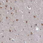 Anti-PSMD4 Antibody