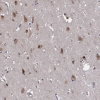 Immunohistochemical staining of human cerebral cortex shows moderate nuclear positivity in neurons.