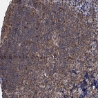 Immunohistochemical staining of human tonsil shows moderate cytoplasmic and nuclear positivity in germinal center cells.