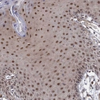Immunohistochemical staining of human skin shows strong nuclear positivity in squamous epithelial cells.
