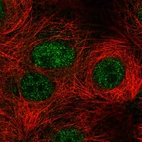 Immunofluorescent staining of human cell line MCF7 shows localization to nucleoplasm.