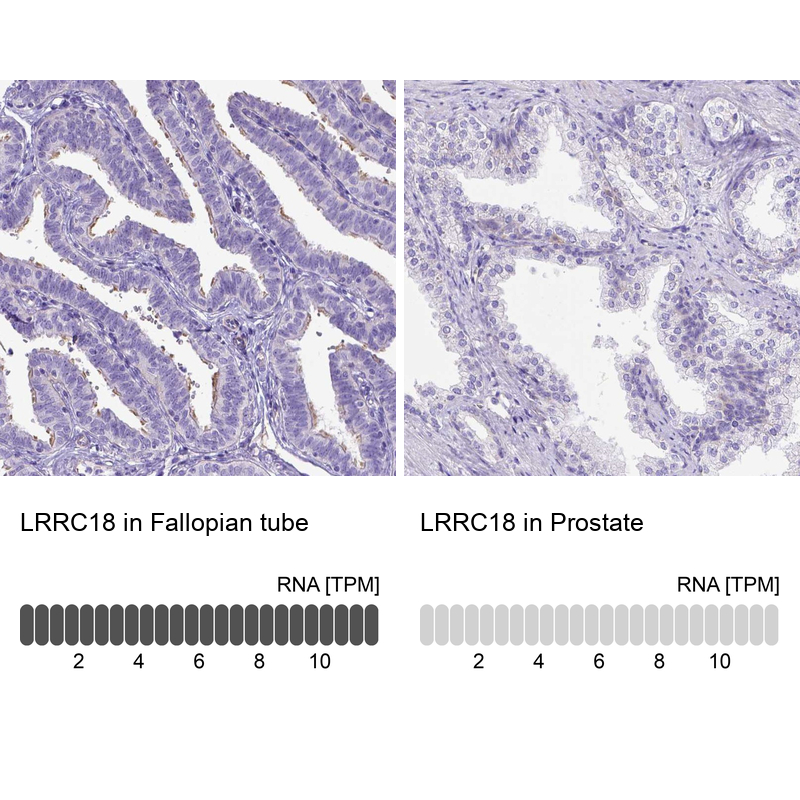Anti-LRRC18 Antibody