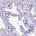 Immunohistochemical staining of human prostate shows low expression as expected.