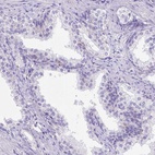 Anti-LRRC18 Antibody