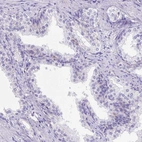 Immunohistochemical staining of human prostate shows low expression as expected.