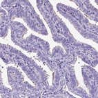 Immunohistochemical staining of human fallopian tube shows high expression.