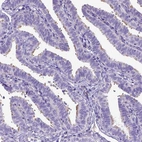 Immunohistochemical staining of human fallopian tube shows high expression.
