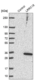 Western blot analysis in control (vector only transfected HEK293T lysate) and LRRC18 over-expression lysate (Co-expressed with a C-terminal myc-DDK tag (~3.1 kDa) in mammalian HEK293T cells, LY423557).