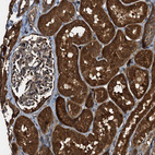 Immunohistochemical staining of human kidney shows strong cytoplasmic positivity in cells in tubules.
