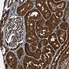 Immunohistochemical staining of human kidney shows strong cytoplasmic positivity in cells in tubules.