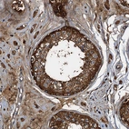 Immunohistochemical staining of human testis shows strong cytoplasmic positivity in cells in seminiferous ducts.