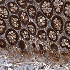 Immunohistochemical staining of human colon shows strong cytoplasmic positivity in glandular cells.