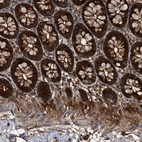Immunohistochemical staining of human colon shows strong cytoplasmic positivity in glandular cells.