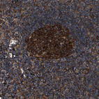 Immunohistochemical staining of human tonsil shows strong cytoplasmic positivity in germinal center cells.