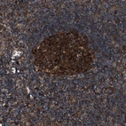 Immunohistochemical staining of human tonsil shows strong cytoplasmic positivity in germinal center cells.