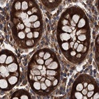 Immunohistochemical staining of human colon using Anti-PEX5 antibody HPA039259.