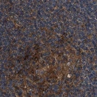 Immunohistochemical staining of human lymph node using Anti-PEX5 antibody HPA039259.