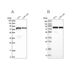 Western blot analysis using Anti-PEX5 antibody HPA039259 (A) shows similar pattern to independent antibody HPA039260 (B).