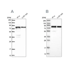 Western blot analysis using Anti-PEX5 antibody HPA039259 (A) shows similar pattern to independent antibody HPA039260 (B).