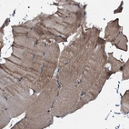 Immunohistochemical staining of human skeletal muscle shows moderate cytoplasmic positivity in myocytes.