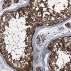 Immunohistochemical staining of human testis shows high expression.