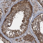 Immunohistochemical staining of human testis shows strong cytoplasmic positivity in cells in seminiferous ducts and leydig cells.