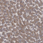 Immunohistochemical staining of human liver shows moderate cytoplasmic positivity in hepatocytes.