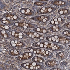Immunohistochemical staining of human duodenum shows strong cytoplasmic positivity in glandular cells.