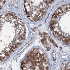 Immunohistochemical staining of human testis shows high expression.