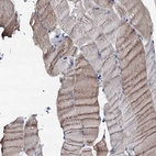 Immunohistochemical staining of human skeletal muscle shows low expression as expected.