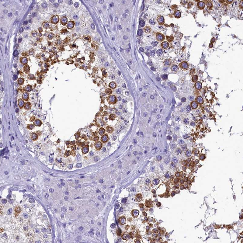Anti-SKA3 Antibody