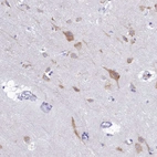 Immunohistochemical staining of human cerebral cortex shows moderate cytoplasmic positivity in neurons.