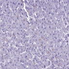 Immunohistochemical staining of human liver shows very weak positivity in hepatocytes.