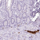 Immunohistochemical staining of human duodenum shows strong cytoplasmic positivity in the peripheral ganglion.
