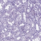 Immunohistochemical staining of human kidney shows no positivity in cells in tubules as expected.