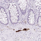 Immunohistochemical staining of human rectum shows strong cytoplasmic positivity in the peripheral ganglion.