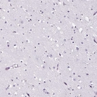 Immunohistochemical staining of human cerebral cortex shows no positivity in neurons as expected.
