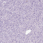 Immunohistochemical staining of human pancreas shows no positivity in exocrine glandular cells as expected.