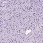 Immunohistochemical staining of human pancreas shows no positivity in exocrine glandular cells as expected.