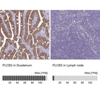 Anti-PLCB3 Antibody