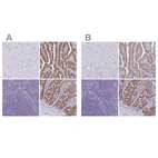 Immunohistochemical staining of human cerebral cortex, duodenum, lymph node and small intestine using Anti-PLCB3 antibody HPA039279 (A) shows similar protein distribution across tissues to independent antibody HPA043907 (B).