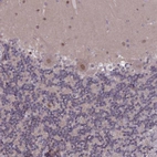 Immunohistochemical staining of human cerebellum shows moderate nuclear positivity in Purkinje cells.