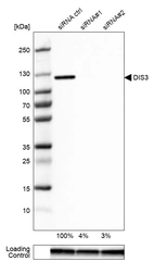 Western blot analysis in U-87MG ATCC cells transfected with control siRNA, target specific siRNA probe #1 and #2, using Anti-DIS3 antibody. Remaining relative intensity is presented. Loading control: Anti-GAPDH.