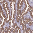 Immunohistochemical staining of human duodenum shows moderate cytoplasmic positivity in glandular cells.