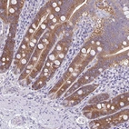 Immunohistochemical staining of human small intestine shows moderate cytoplasmic positivity in glandular cells.