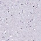 Immunohistochemical staining of human cerebral cortex shows no positivity in neurons as expected.