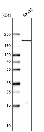 Western blot analysis in human cell line RH-30.